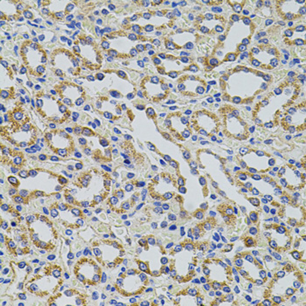 Immunohistochemistry of paraffin-embedded rat kidney using TRMT2A antibody (19-966) at dilution of 1:100 (40x lens) .
