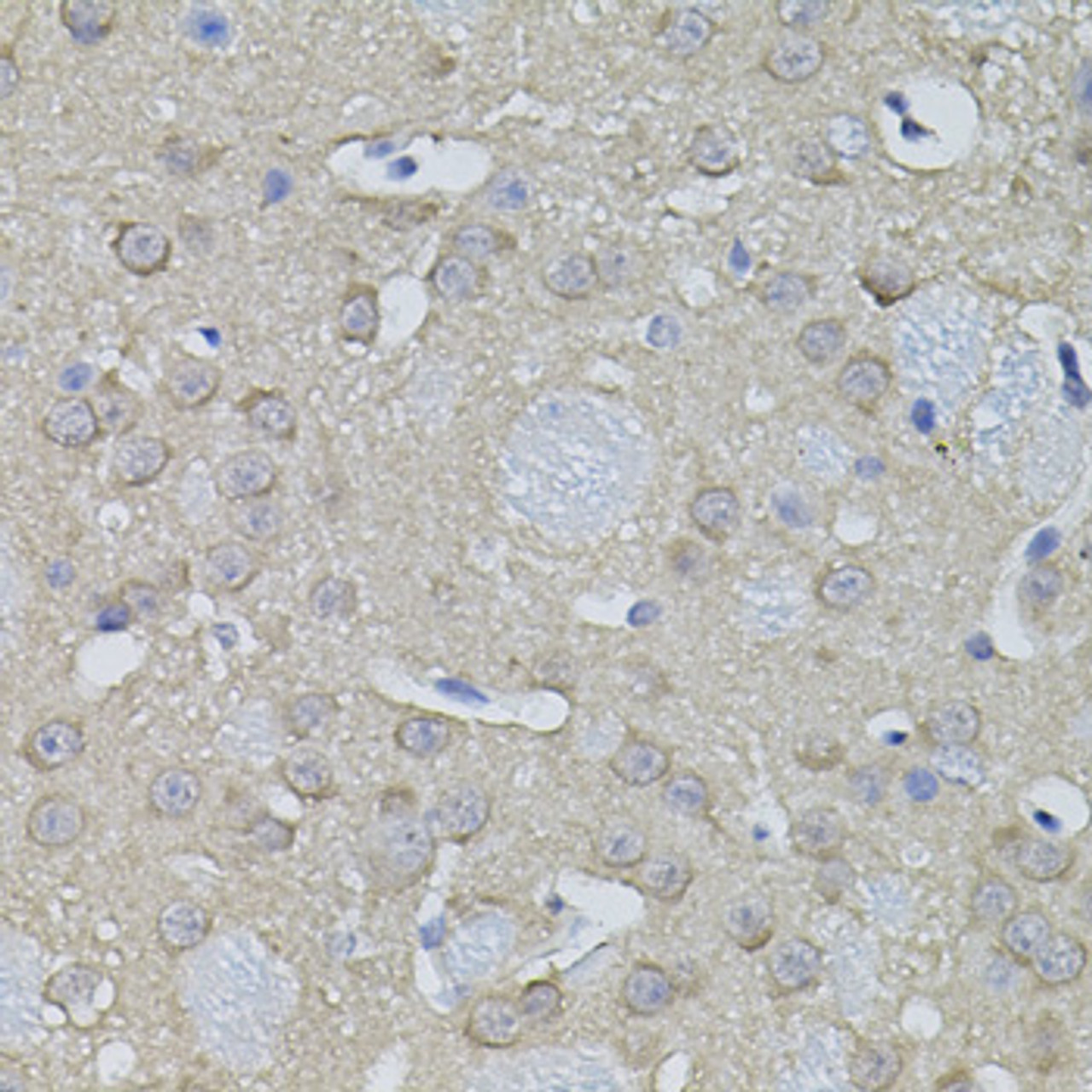 Immunohistochemistry of paraffin-embedded mouse brain using ACO1 antibody (19-974) (40x lens) .