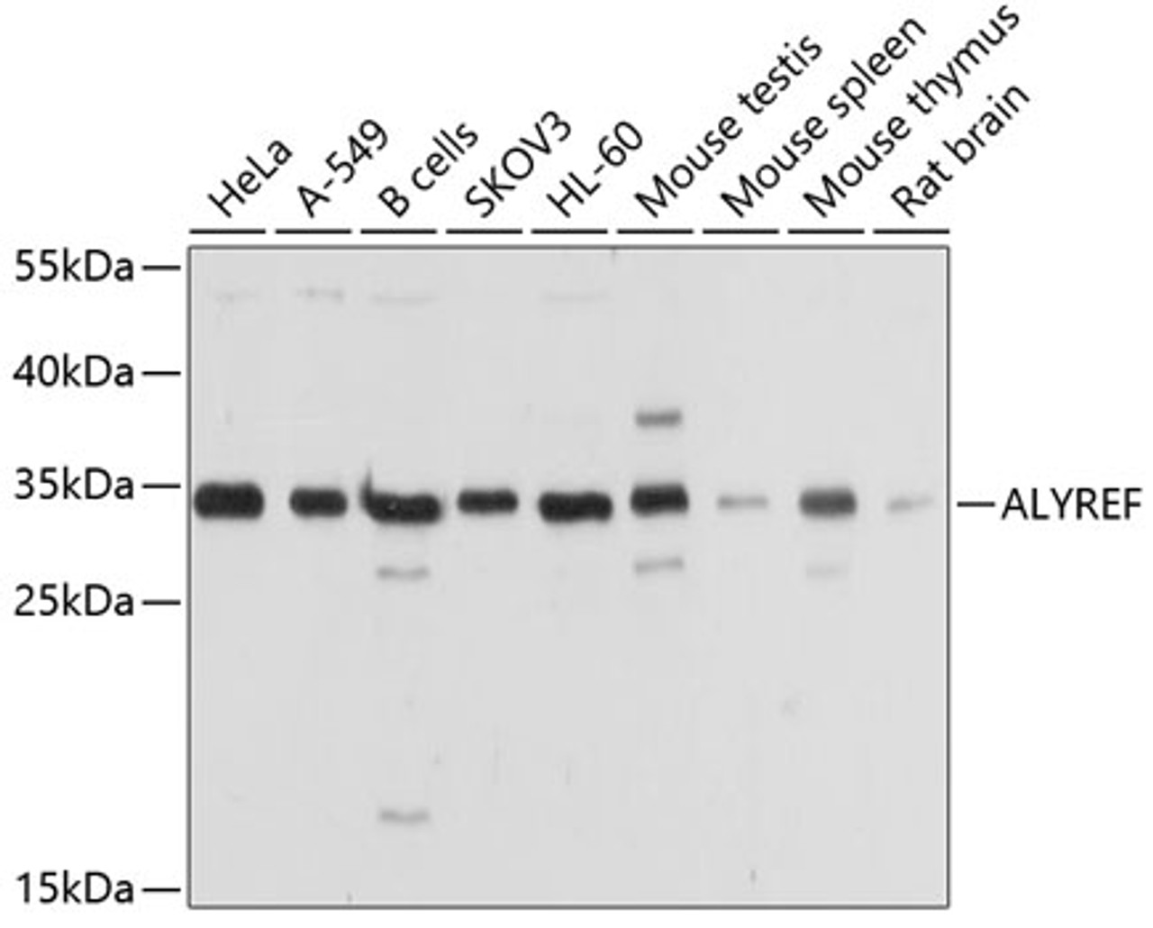 Western blot analysis of extracts of various cell lines, using ALYREF antibody (19-975) at 1:1000 dilution.<br/>Secondary antibody: HRP Goat Anti-Rabbit IgG (H+L) at 1:10000 dilution.<br/>Lysates/proteins: 25ug per lane.<br/>Blocking buffer: 3% nonfat dry milk in TBST.<br/>Detection: ECL Basic Kit.<br/>Exposure time: 5s.