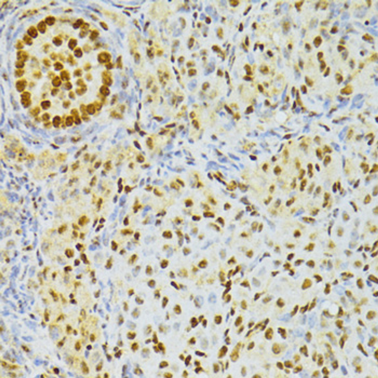 Immunohistochemistry of paraffin-embedded rat ovary using ALYREF antibody (19-975) at dilution of 1:100 (40x lens) .