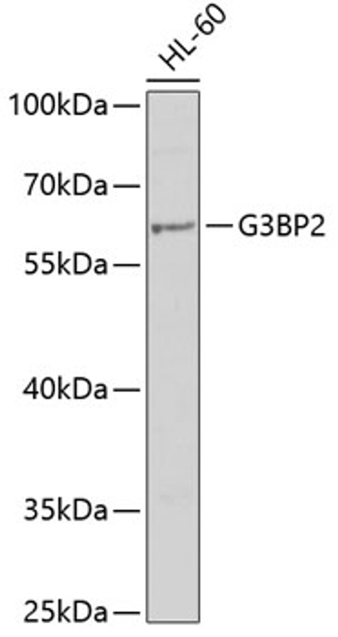 Western blot analysis of extracts of HL-60 cells, using G3BP2 antibody (19-981) at 1:1000 dilution.<br/>Secondary antibody: HRP Goat Anti-Rabbit IgG (H+L) at 1:10000 dilution.<br/>Lysates/proteins: 25ug per lane.<br/>Blocking buffer: 3% nonfat dry milk in TBST.<br/>Detection: ECL Basic Kit.<br/>Exposure time: 15s.