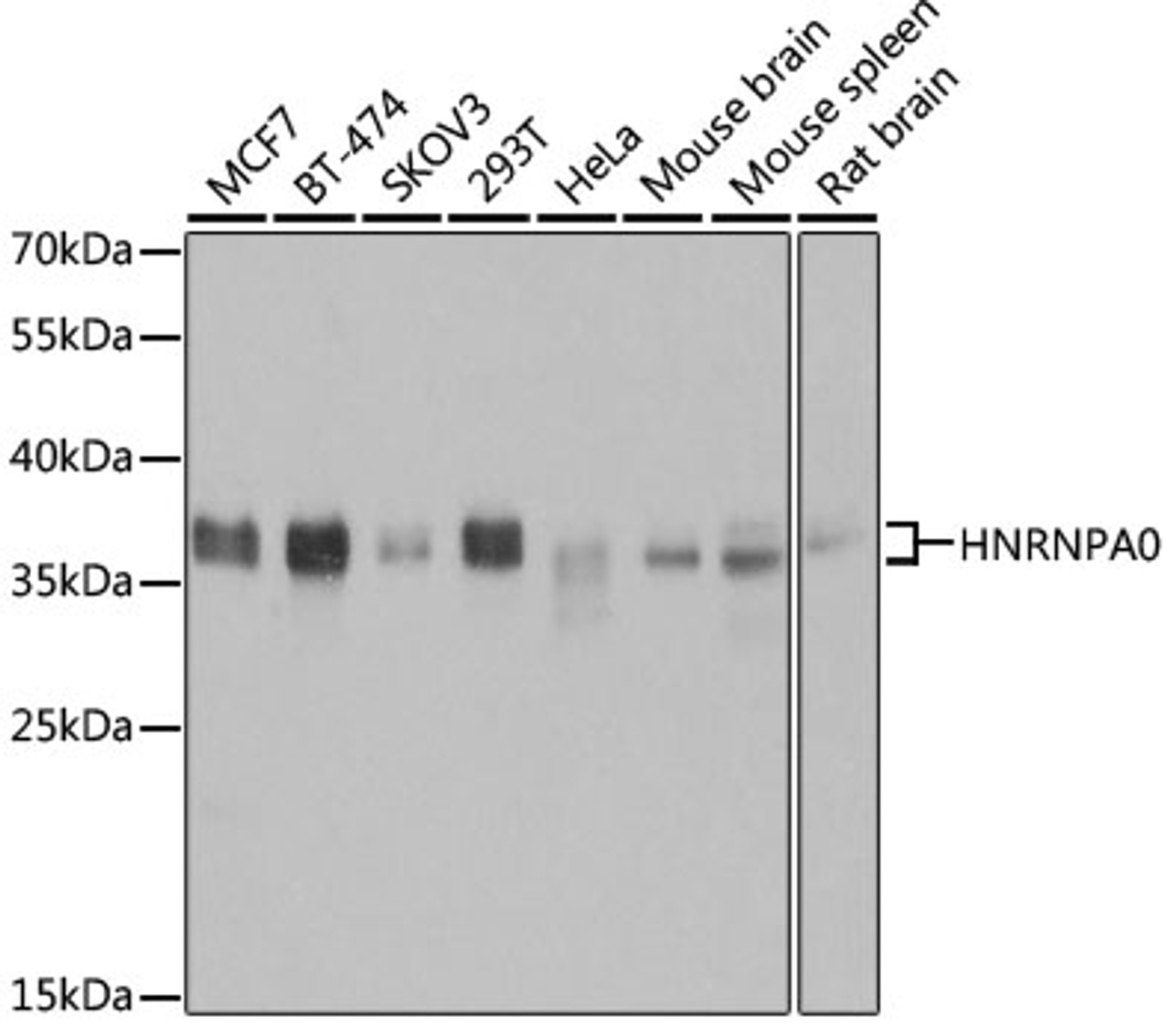 Western blot analysis of extracts of various cell lines, using HNRNPA0 antibody (19-983) at 1:3000 dilution.<br/>Secondary antibody: HRP Goat Anti-Rabbit IgG (H+L) at 1:10000 dilution.<br/>Lysates/proteins: 25ug per lane.<br/>Blocking buffer: 3% nonfat dry milk in TBST.<br/>Detection: ECL Basic Kit.<br/>Exposure time: 1s.