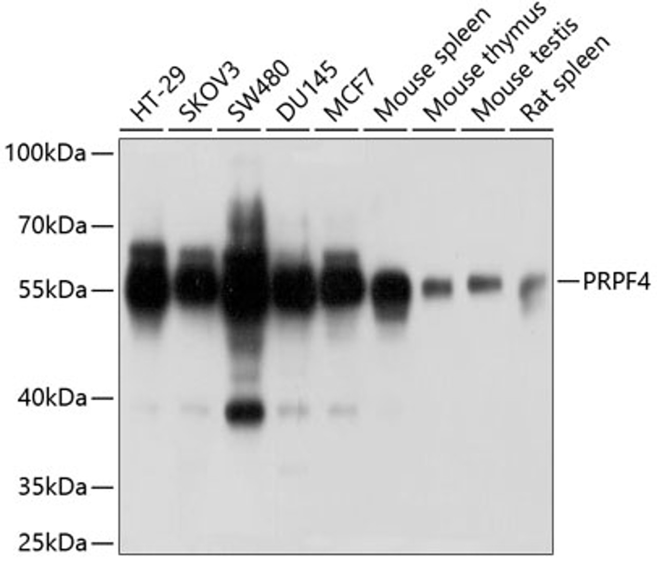 Western blot analysis of extracts of various cell lines, using PRPF4 antibody (19-987) at 1:1000 dilution.<br/>Secondary antibody: HRP Goat Anti-Rabbit IgG (H+L) at 1:10000 dilution.<br/>Lysates/proteins: 25ug per lane.<br/>Blocking buffer: 3% nonfat dry milk in TBST.<br/>Detection: ECL Basic Kit.<br/>Exposure time: 1s.