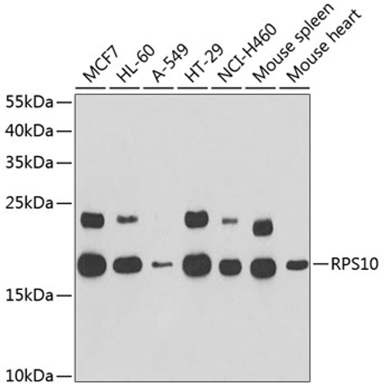 Western blot analysis of extracts of various cell lines, using RPS10 antibody (19-990) at 1:1000 dilution.<br/>Secondary antibody: HRP Goat Anti-Rabbit IgG (H+L) at 1:10000 dilution.<br/>Lysates/proteins: 25ug per lane.<br/>Blocking buffer: 3% nonfat dry milk in TBST.<br/>Detection: ECL Basic Kit.<br/>Exposure time: 10s.