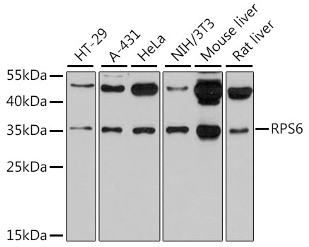 Western blot analysis of extracts of various cell lines, using RPS6 antibody (19-991) at 1:1000 dilution.<br/>Secondary antibody: HRP Goat Anti-Rabbit IgG (H+L) at 1:10000 dilution.<br/>Lysates/proteins: 25ug per lane.<br/>Blocking buffer: 3% nonfat dry milk in TBST.<br/>Detection: ECL Basic Kit.<br/>Exposure time: 30s.