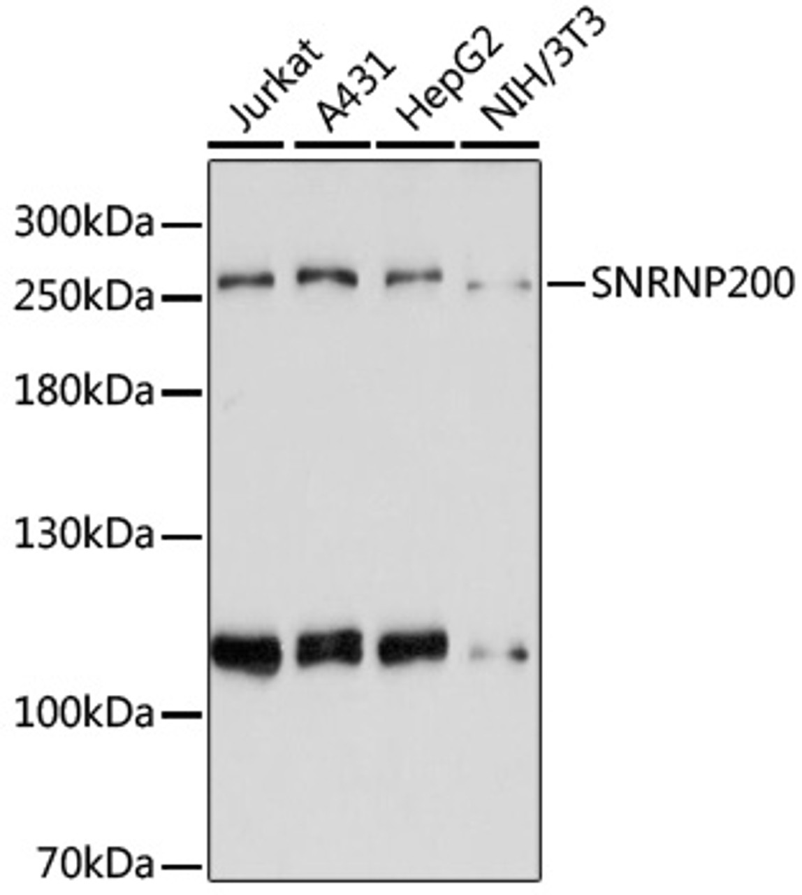 Western blot analysis of extracts of various cell lines, using SNRNP200 antibody (19-992) at 1:3000 dilution.<br/>Secondary antibody: HRP Goat Anti-Rabbit IgG (H+L) at 1:10000 dilution.<br/>Lysates/proteins: 25ug per lane.<br/>Blocking buffer: 3% nonfat dry milk in TBST.<br/>Detection: ECL Basic Kit.<br/>Exposure time: 90s.