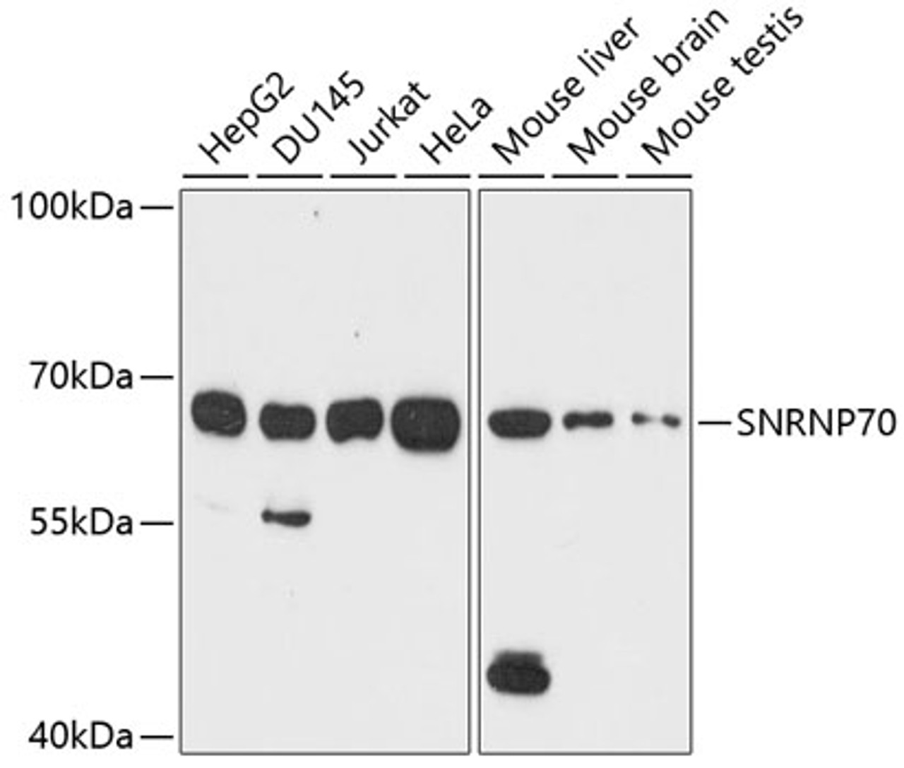 Western blot analysis of extracts of various cell lines, using SNRNP70 antibody (19-993) at 1:1000 dilution.<br/>Secondary antibody: HRP Goat Anti-Rabbit IgG (H+L) at 1:10000 dilution.<br/>Lysates/proteins: 25ug per lane.<br/>Blocking buffer: 3% nonfat dry milk in TBST.<br/>Detection: ECL Enhanced Kit.<br/>Exposure time: 90s.