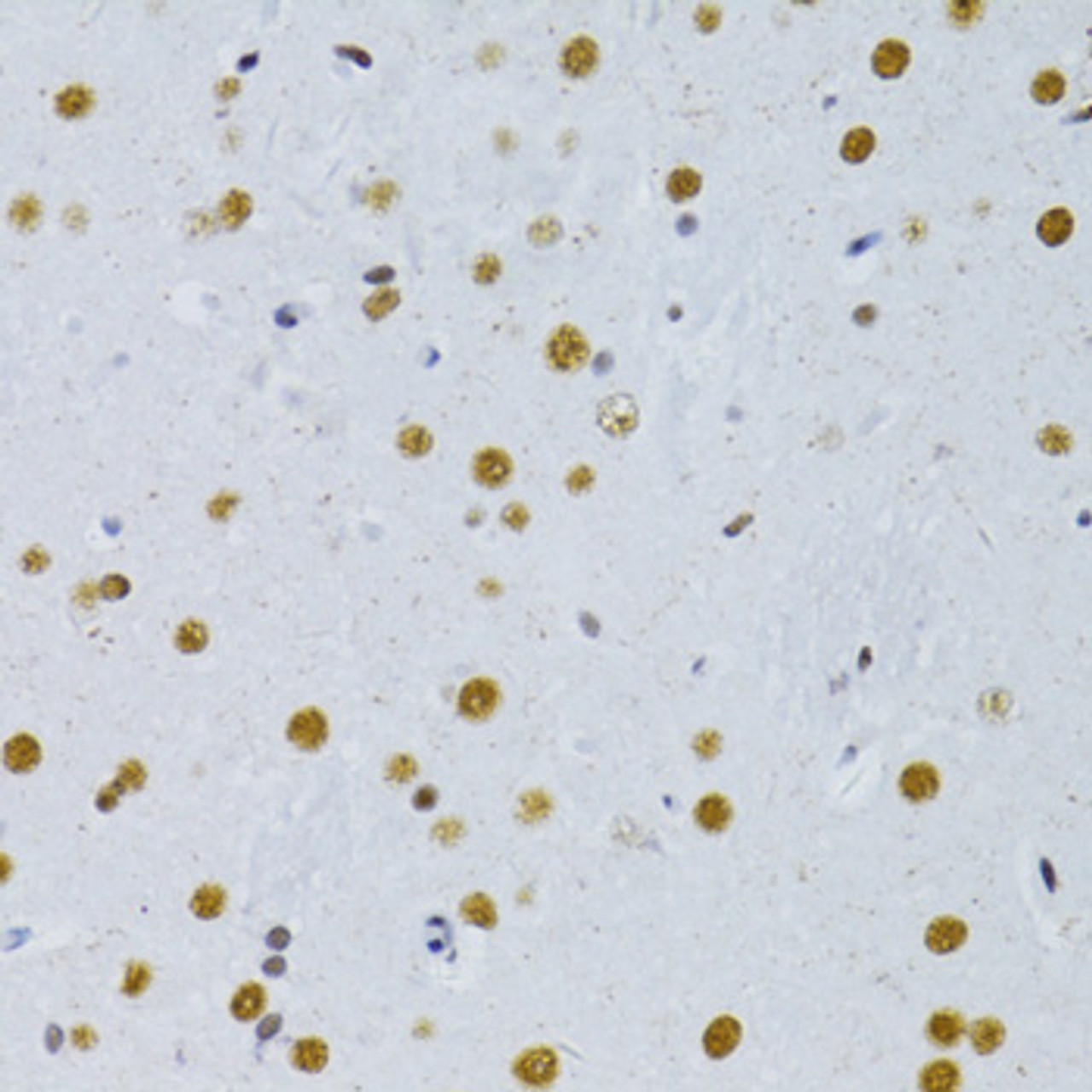 Immunohistochemistry of paraffin-embedded rat brain using SNRNP70 antibody (19-993) at dilution of 1:100 (40x lens) .