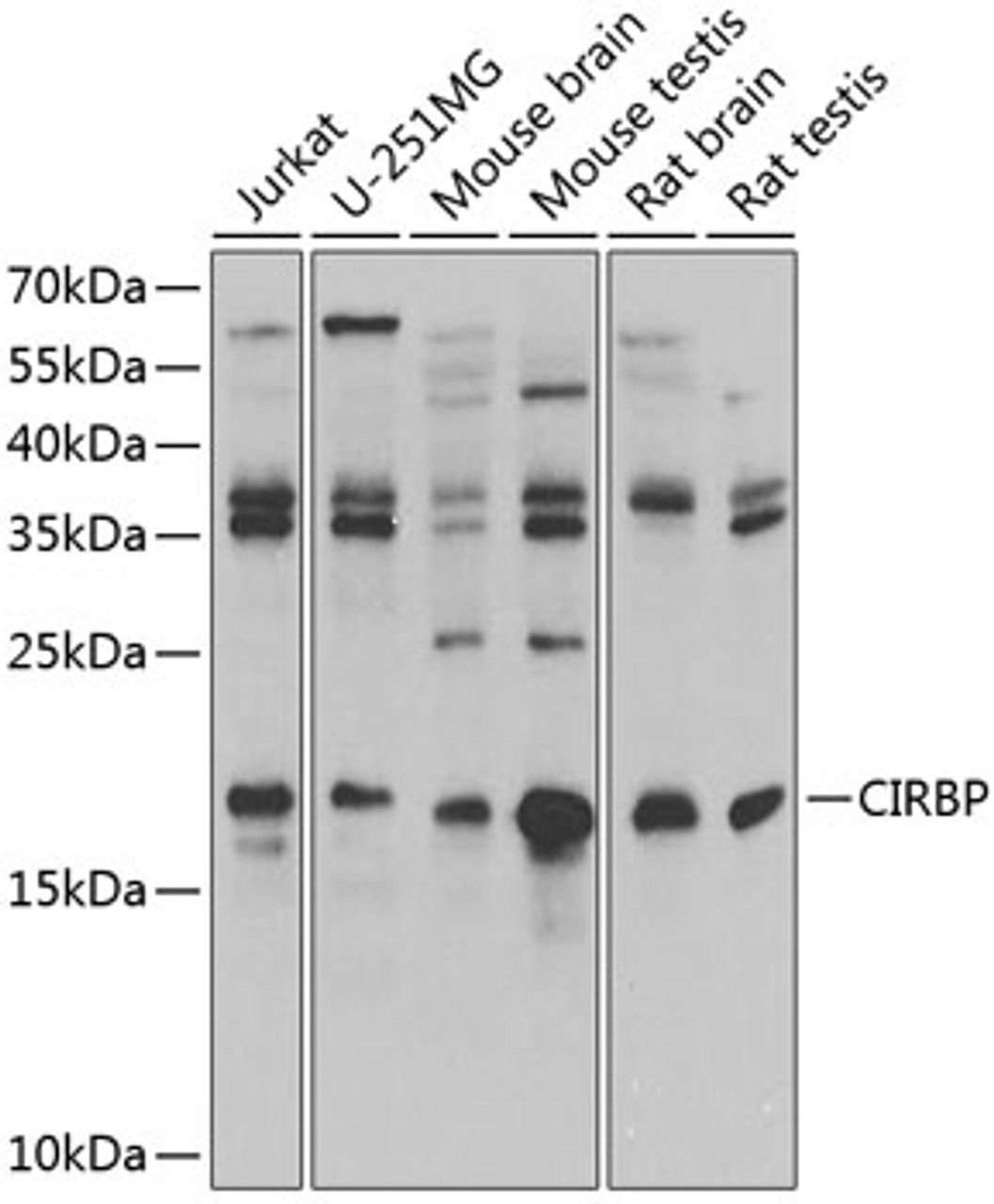 Western blot analysis of extracts of various cell lines, using CIRBP antibody (19-999) at 1:1000 dilution.<br/>Secondary antibody: HRP Goat Anti-Rabbit IgG (H+L) at 1:10000 dilution.<br/>Lysates/proteins: 25ug per lane.<br/>Blocking buffer: 3% nonfat dry milk in TBST.<br/>Detection: ECL Enhanced Kit.<br/>Exposure time: 1s.