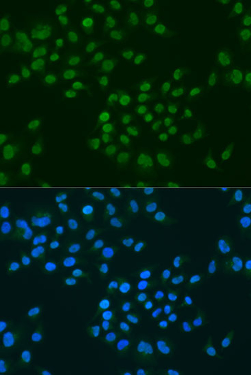 Immunofluorescence analysis of U2OS cells using CIRBP antibody (19-999) at dilution of 1:100. Blue: DAPI for nuclear staining.