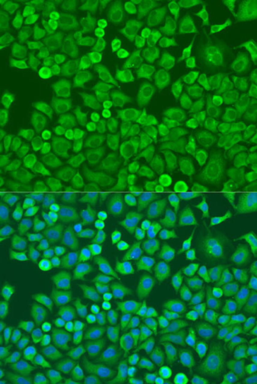 Immunofluorescence analysis of U2OS cells using EIF4E antibody (22-003) at dilution of 1:100. Blue: DAPI for nuclear staining.