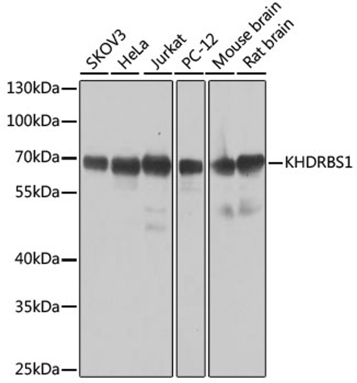 Western blot analysis of extracts of various cell lines, using KHDRBS1 antibody (22-007) at 1:1000 dilution.<br/>Secondary antibody: HRP Goat Anti-Rabbit IgG (H+L) at 1:10000 dilution.<br/>Lysates/proteins: 25ug per lane.<br/>Blocking buffer: 3% nonfat dry milk in TBST.<br/>Detection: ECL Basic Kit.<br/>Exposure time: 10s.