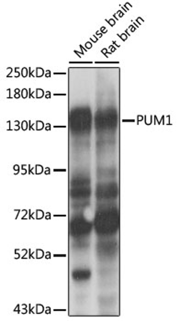 Western blot analysis of extracts of various cell lines, using PUM1 antibody (22-010) at 1:1000 dilution.<br/>Secondary antibody: HRP Goat Anti-Rabbit IgG (H+L) at 1:10000 dilution.<br/>Lysates/proteins: 25ug per lane.<br/>Blocking buffer: 3% nonfat dry milk in TBST.<br/>Detection: ECL Enhanced Kit.<br/>Exposure time: 15s.