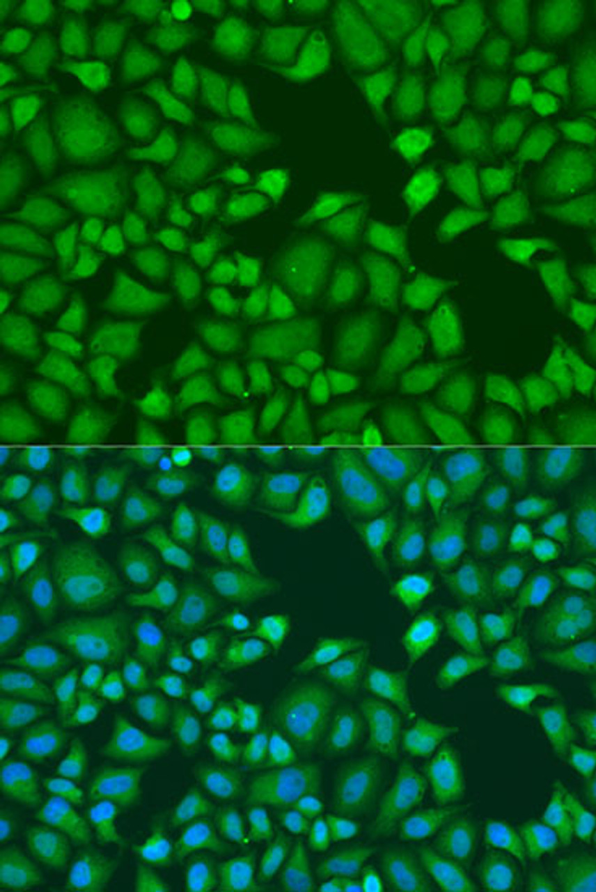 Immunofluorescence analysis of U2OS cells using TNRC6A antibody (22-011) at dilution of 1:100. Blue: DAPI for nuclear staining.