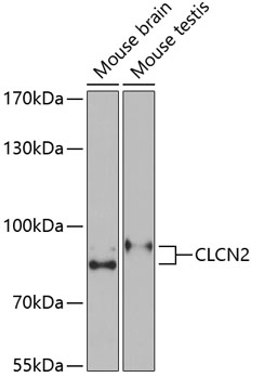 Western blot analysis of extracts of various cell lines, using CLCN2 Antibody (22-013) at 1:1000 dilution.<br/>Secondary antibody: HRP Goat Anti-Rabbit IgG (H+L) at 1:10000 dilution.<br/>Lysates/proteins: 25ug per lane.<br/>Blocking buffer: 3% nonfat dry milk in TBST.<br/>Detection: ECL Basic Kit.<br/>Exposure time: 90s.