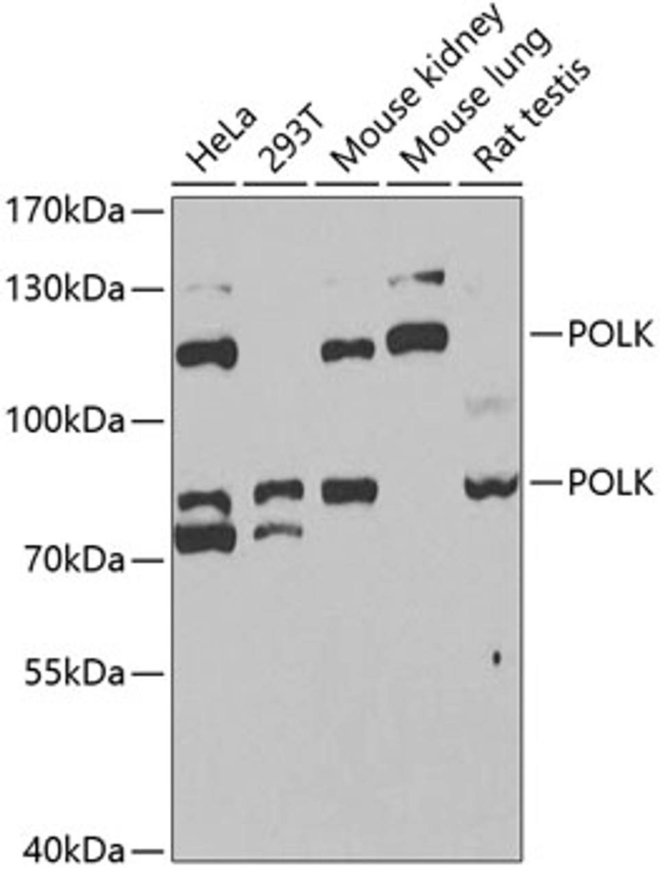 Western blot analysis of extracts of various cell lines, using POLK antibody (22-014) at 1:1000 dilution.<br/>Secondary antibody: HRP Goat Anti-Rabbit IgG (H+L) at 1:10000 dilution.<br/>Lysates/proteins: 25ug per lane.<br/>Blocking buffer: 3% nonfat dry milk in TBST.<br/>Detection: ECL Basic Kit.<br/>Exposure time: 90s.