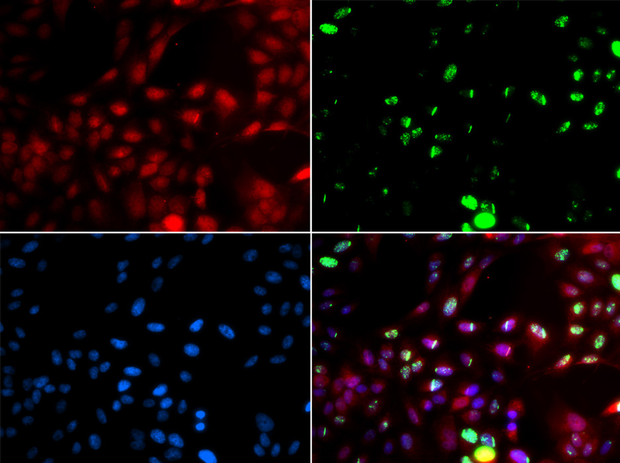 Immunofluorescence analysis of GFP-RNF168 transgenic U2OS cells using POLK antibody (22-014) . Green：GFP-RNF168 fusion protein expression for DNA damage marker.Blue: DAPI for nuclear staining.RNF168 (GFP) can be used to mark cells damaged by UV-A laser for they always gather around DNA damage region.