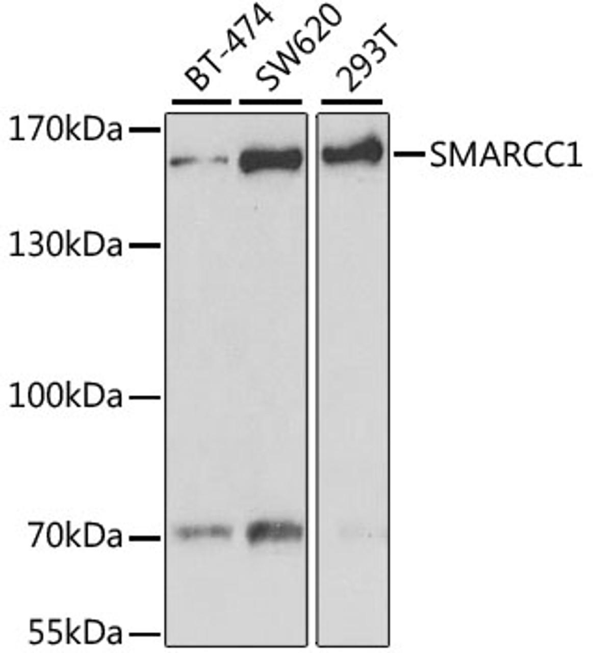 Western blot analysis of extracts of various cell lines, using SMARCC1 antibody (22-018) at 1:1000 dilution.<br/>Secondary antibody: HRP Goat Anti-Rabbit IgG (H+L) at 1:10000 dilution.<br/>Lysates/proteins: 25ug per lane.<br/>Blocking buffer: 3% nonfat dry milk in TBST.<br/>Detection: ECL Basic Kit.<br/>Exposure time: 120s.