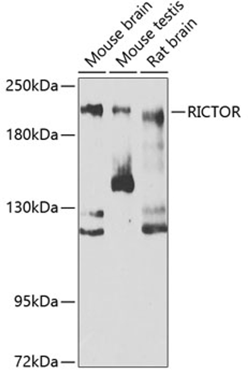 Western blot analysis of extracts of various cell lines, using RICTOR antibody (22-021) at 1:300 dilution._Secondary antibody: HRP Goat Anti-Rabbit IgG (H+L) at 1:10000 dilution._Lysates/proteins: 25ug per lane._Blocking buffer: 3% nonfat dry milk in TBST._Detection: ECL Enhanced Kit._Exposure time: 90s.