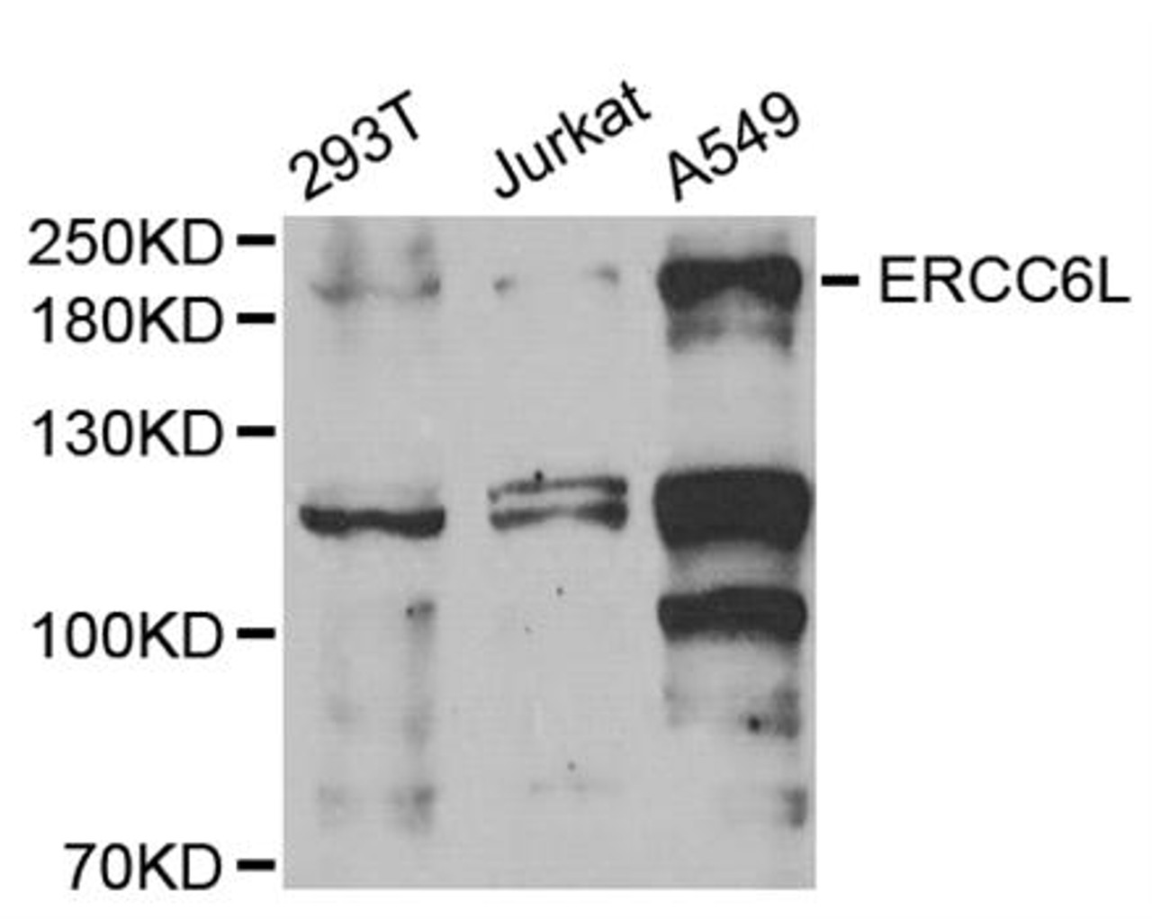 Western blot analysis of extracts of various cell lines, using ERCC6L antibody (22-025) at 1:1000 dilution.<br/>Secondary antibody: HRP Goat Anti-Rabbit IgG (H+L) at 1:10000 dilution.<br/>Lysates/proteins: 25ug per lane.<br/>Blocking buffer: 3% nonfat dry milk in TBST.<br/>Detection: ECL Basic Kit.<br/>Exposure time: 90s.