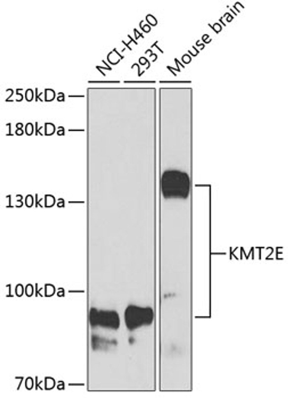 Western blot analysis of extracts of various cell lines, using KMT2E Antibody (22-027) at 1:1000 dilution.<br/>Secondary antibody: HRP Goat Anti-Rabbit IgG (H+L) at 1:10000 dilution.<br/>Lysates/proteins: 25ug per lane.<br/>Blocking buffer: 3% nonfat dry milk in TBST.<br/>Detection: ECL Enhanced Kit.<br/>Exposure time: 30s.