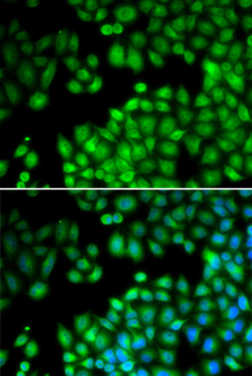 Immunofluorescence analysis of U2OS cells using KMT2E antibody (22-027) . Blue: DAPI for nuclear staining.