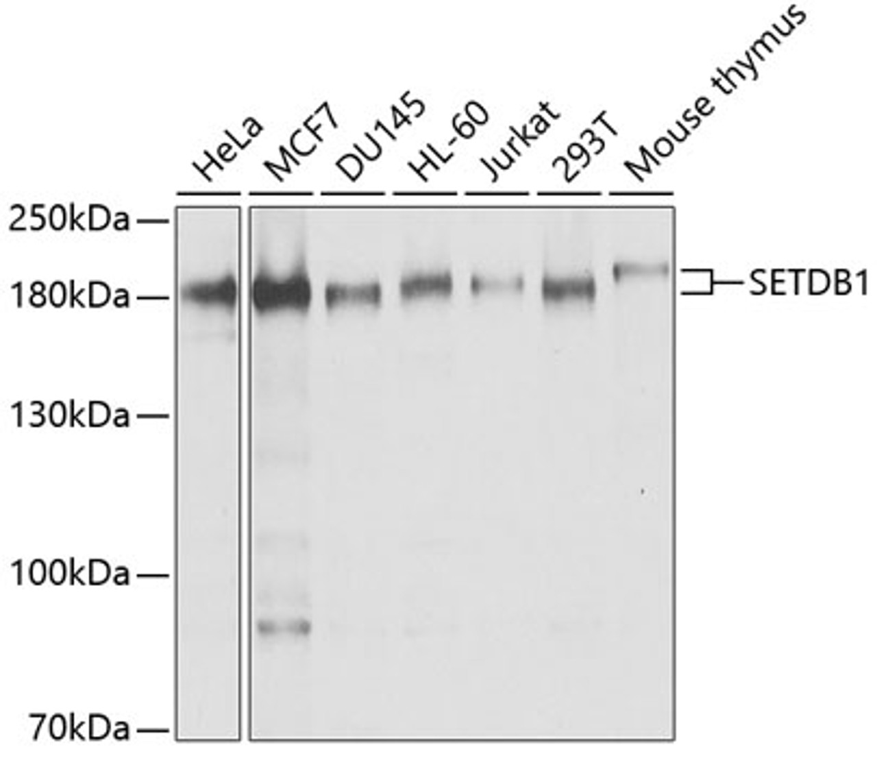 Western blot analysis of extracts of various cell lines, using SETDB1 antibody (22-030) at 1:1000 dilution.<br/>Secondary antibody: HRP Goat Anti-Rabbit IgG (H+L) at 1:10000 dilution.<br/>Lysates/proteins: 25ug per lane.<br/>Blocking buffer: 3% nonfat dry milk in TBST.<br/>Detection: ECL Basic Kit.<br/>Exposure time: 15s.