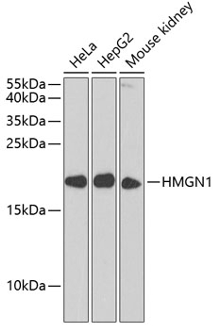 Western blot analysis of extracts of various cell lines, using HMGN1 antibody (22-035) at 1:1000 dilution._Secondary antibody: HRP Goat Anti-Rabbit IgG (H+L) at 1:10000 dilution._Lysates/proteins: 25ug per lane._Blocking buffer: 3% nonfat dry milk in TBST._Detection: ECL Enhanced Kit._Exposure time: 30s.