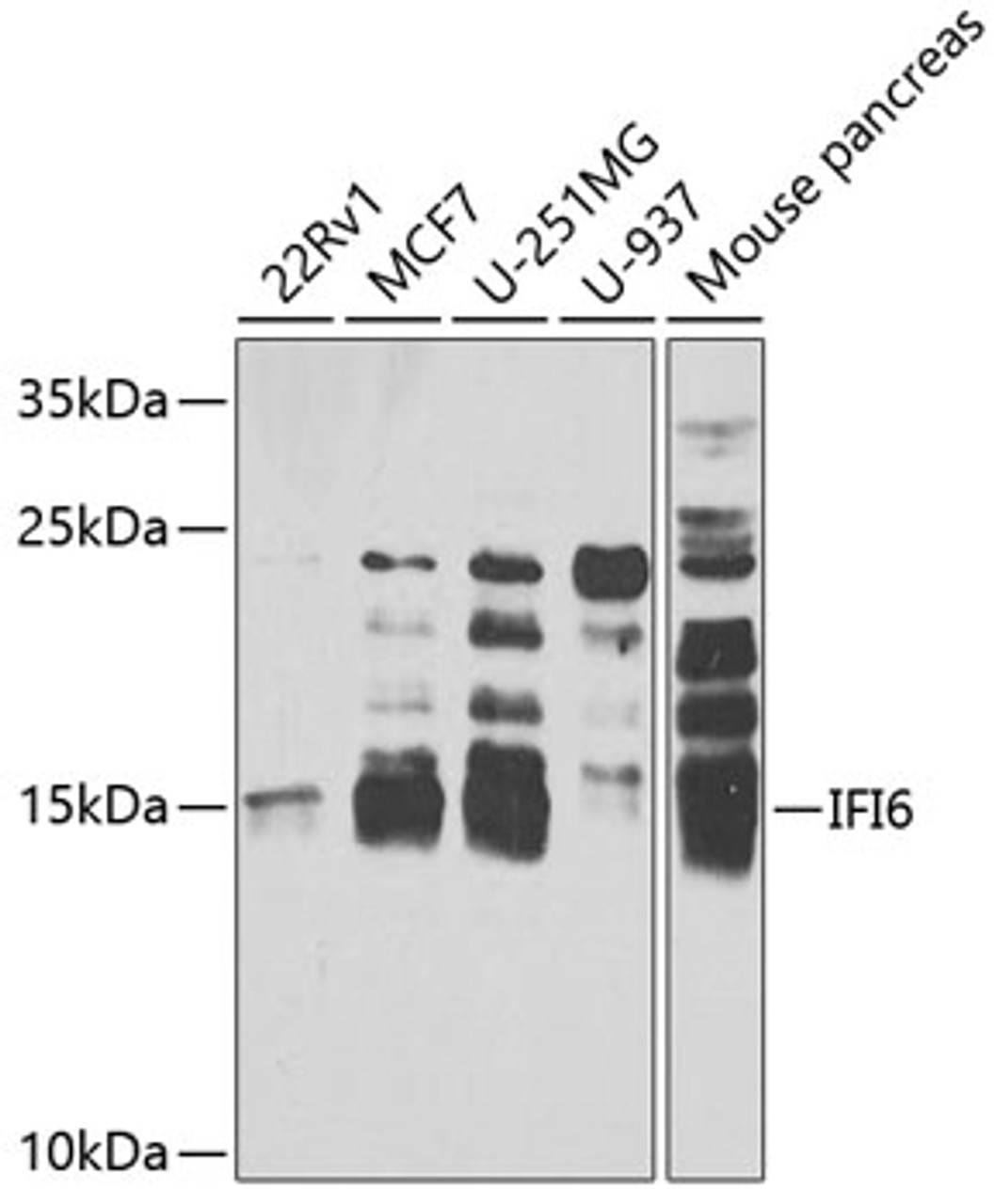 Western blot analysis of extracts of various cell lines, using IFI6 antibody (22-036) at 1:1000 dilution.<br/>Secondary antibody: HRP Goat Anti-Rabbit IgG (H+L) at 1:10000 dilution.<br/>Lysates/proteins: 25ug per lane.<br/>Blocking buffer: 3% nonfat dry milk in TBST.<br/>Detection: ECL Enhanced Kit.<br/>Exposure time: 40s.