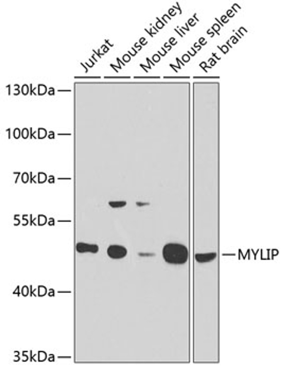 Western blot analysis of extracts of various cell lines, using MYLIP antibody (22-039) at 1:1000 dilution.<br/>Secondary antibody: HRP Goat Anti-Rabbit IgG (H+L) at 1:10000 dilution.<br/>Lysates/proteins: 25ug per lane.<br/>Blocking buffer: 3% nonfat dry milk in TBST.<br/>Detection: ECL Basic Kit.<br/>Exposure time: 90s.