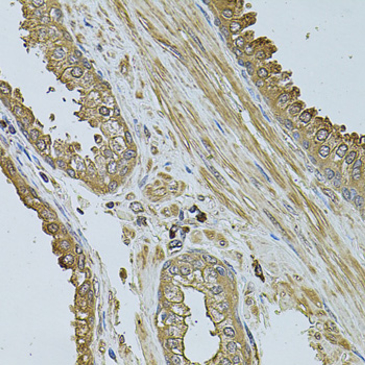 Immunohistochemistry of paraffin-embedded human prostate using MYLIP antibody (22-039) at dilution of 1:100 (40x lens) .