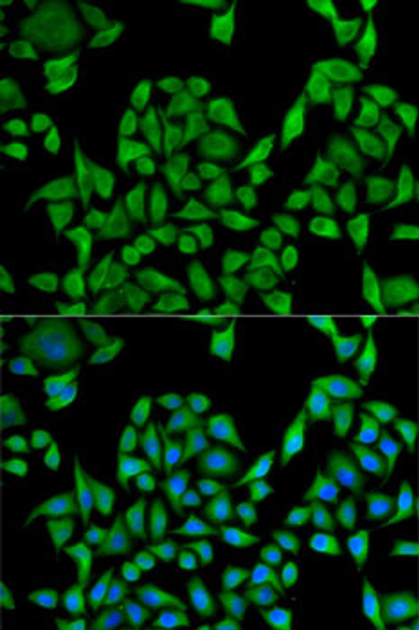 Immunofluorescence analysis of U2OS cells using UGT1A1 antibody (22-045) . Blue: DAPI for nuclear staining.