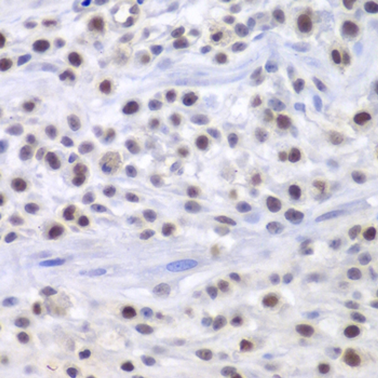 Immunohistochemistry of paraffin-embedded mouse osteosarcoma using HAT1 antibody (22-046) at dilution of 1:200 (40x lens) .