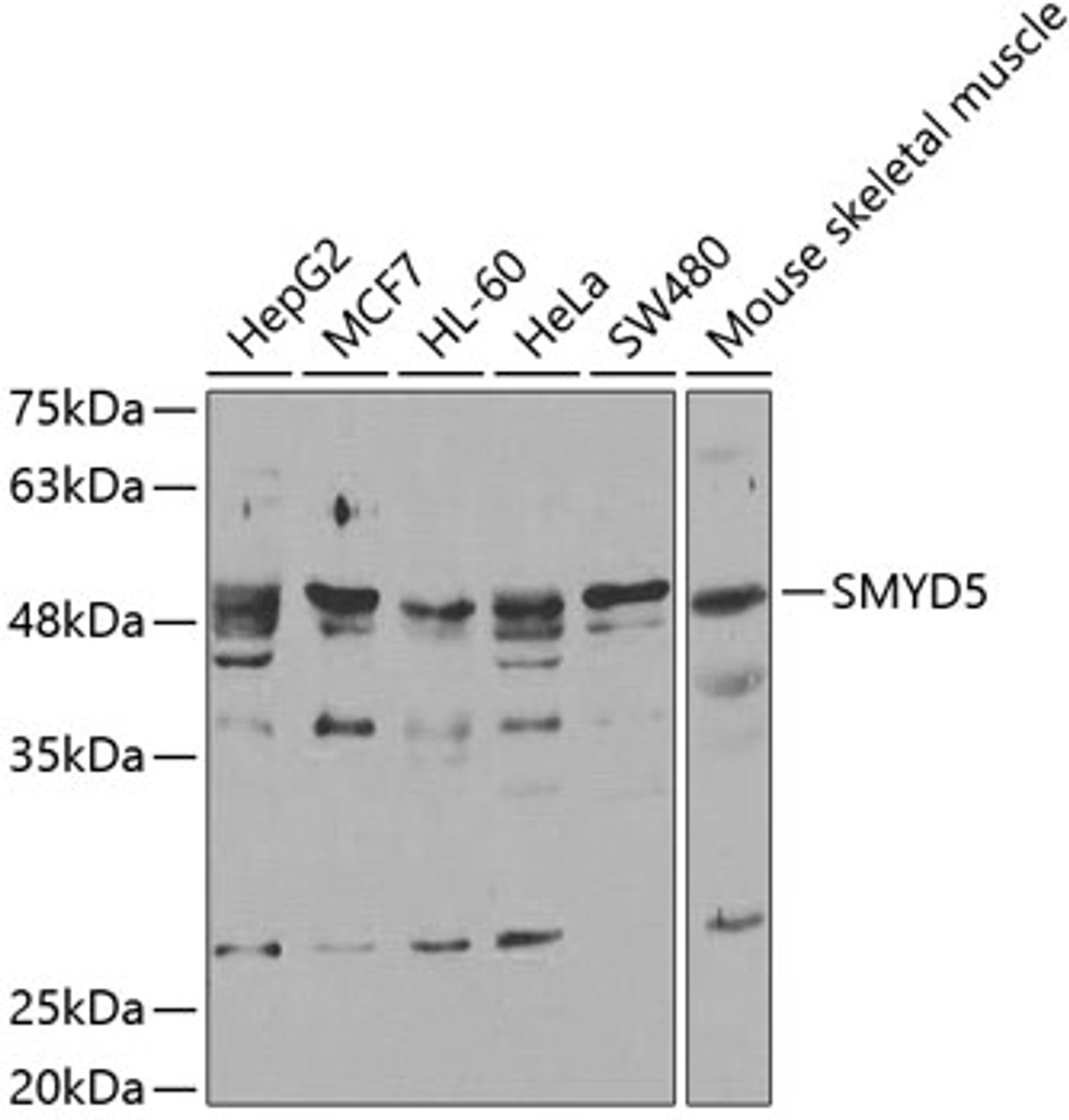 Western blot analysis of extracts of various cell lines, using SMYD5 antibody (22-047) .<br/>Secondary antibody: HRP Goat Anti-Rabbit IgG (H+L) at 1:10000 dilution.<br/>Lysates/proteins: 25ug per lane.<br/>Blocking buffer: 3% nonfat dry milk in TBST.