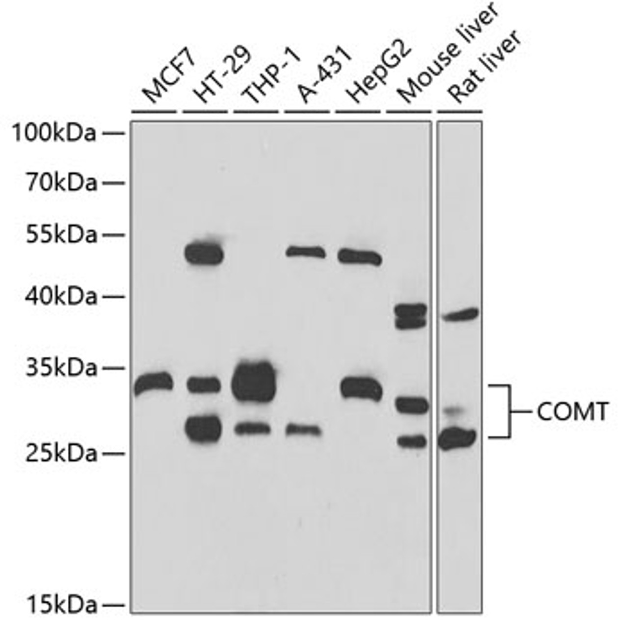 Western blot analysis of extracts of various cell lines, using COMT antibody (22-051) at 1:1000 dilution.<br/>Secondary antibody: HRP Goat Anti-Rabbit IgG (H+L) at 1:10000 dilution.<br/>Lysates/proteins: 25ug per lane.<br/>Blocking buffer: 3% nonfat dry milk in TBST.<br/>Detection: ECL Basic Kit.<br/>Exposure time: 60s.