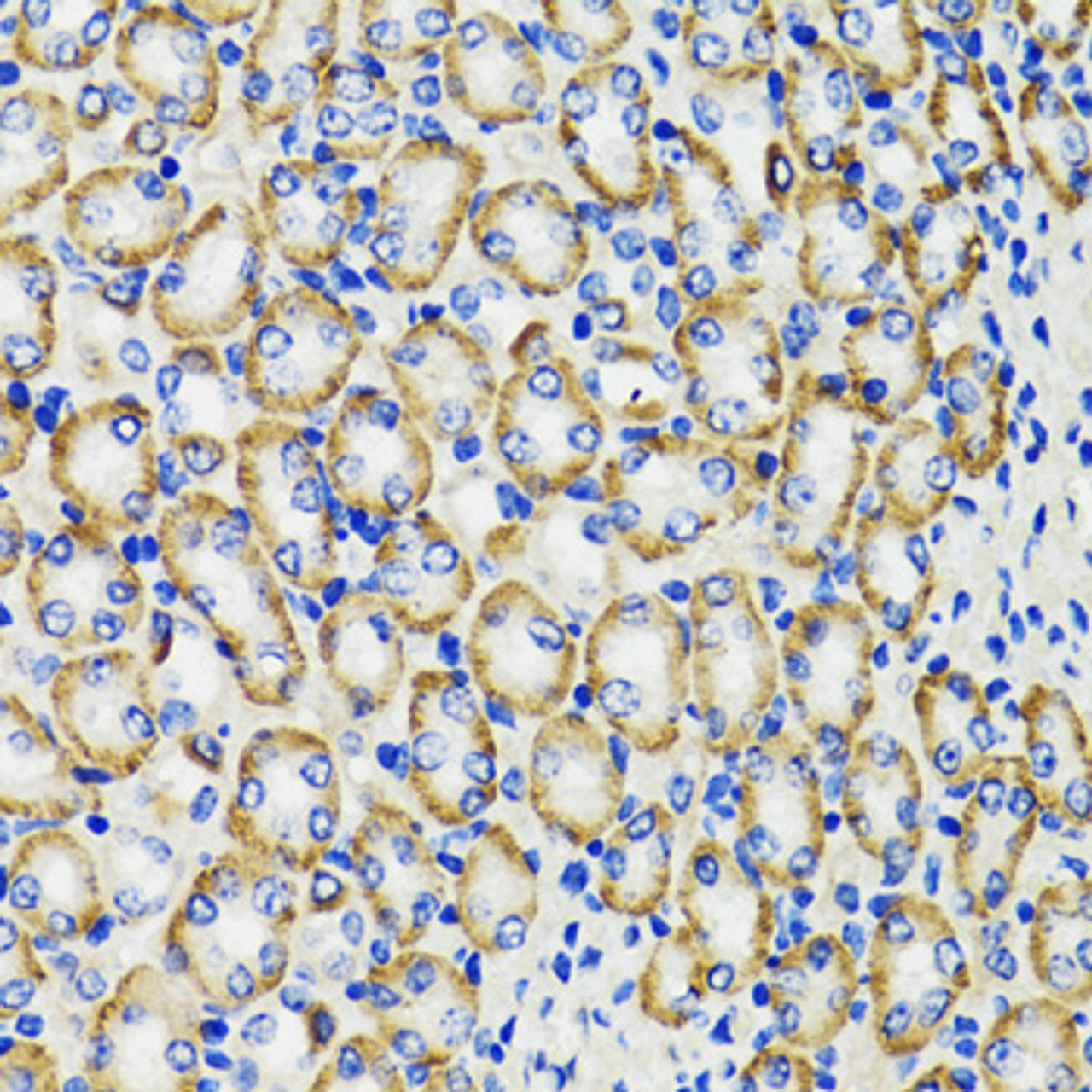 Immunohistochemistry of paraffin-embedded rat kidney using COMT antibody (22-051) at dilution of 1:100 (40x lens) .