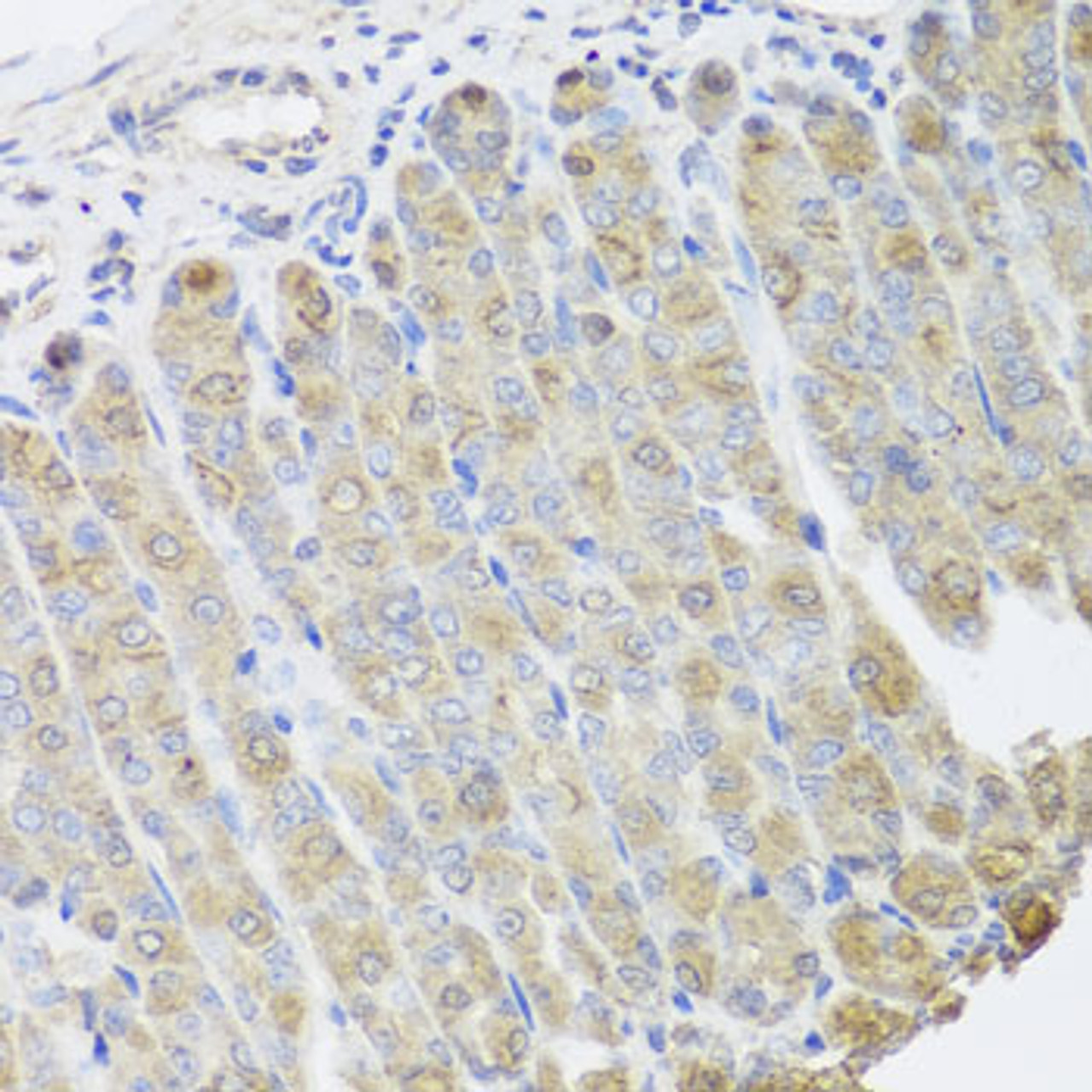 Immunohistochemistry of paraffin-embedded mouse stomach using BGLAP antibody (22-052) at dilution of 1:100 (40x lens) .