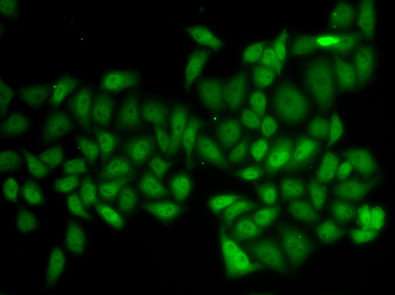 Immunofluorescence analysis of HeLa cells using ATXN1 antibody (22-058) .