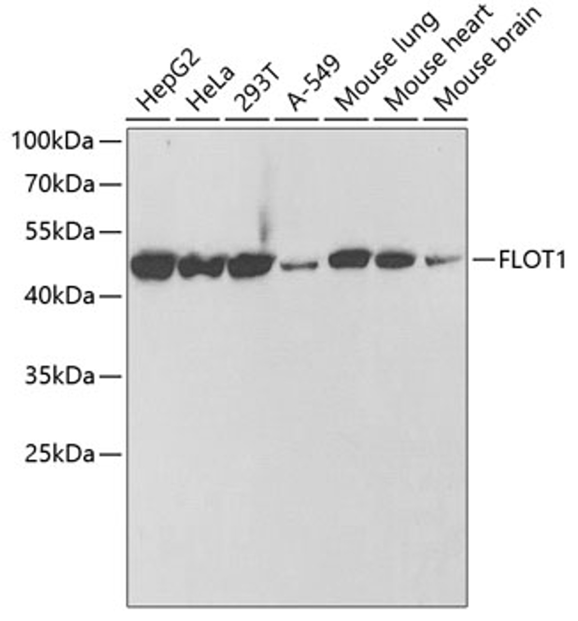 Western blot analysis of extracts of various cell lines, using FLOT1 antibody (22-060) at 1:1000 dilution.<br/>Secondary antibody: HRP Goat Anti-Rabbit IgG (H+L) at 1:10000 dilution.<br/>Lysates/proteins: 25ug per lane.<br/>Blocking buffer: 3% nonfat dry milk in TBST.<br/>Detection: ECL Basic Kit.<br/>Exposure time: 30s.