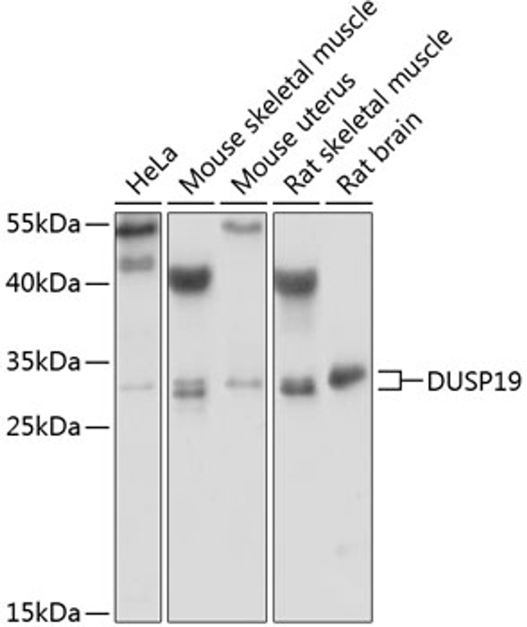 Western blot analysis of extracts of various cell lines, using DUSP19 antibody (22-065) at 1:1000 dilution.<br/>Secondary antibody: HRP Goat Anti-Rabbit IgG (H+L) at 1:10000 dilution.<br/>Lysates/proteins: 25ug per lane.<br/>Blocking buffer: 3% nonfat dry milk in TBST.<br/>Detection: ECL Basic Kit.<br/>Exposure time: 15s.