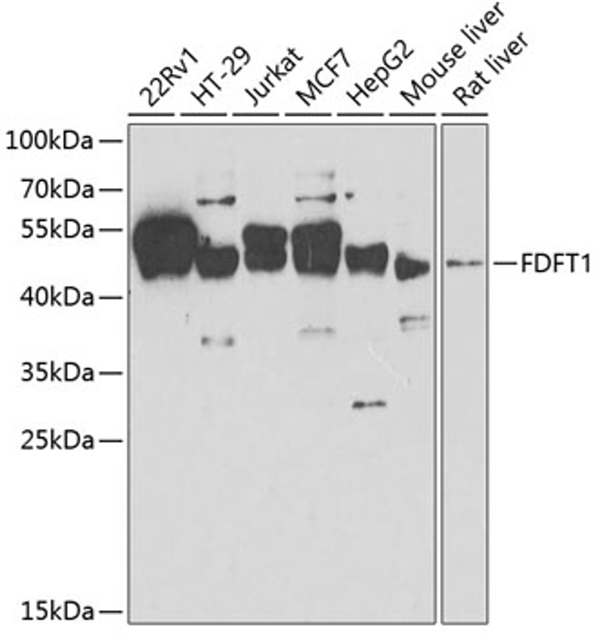 Western blot analysis of extracts of various cell lines, using FDFT1 antibody (22-067) at 1:1000 dilution.<br/>Secondary antibody: HRP Goat Anti-Rabbit IgG (H+L) at 1:10000 dilution.<br/>Lysates/proteins: 25ug per lane.<br/>Blocking buffer: 3% nonfat dry milk in TBST.<br/>Detection: ECL Enhanced Kit.<br/>Exposure time: 60s.