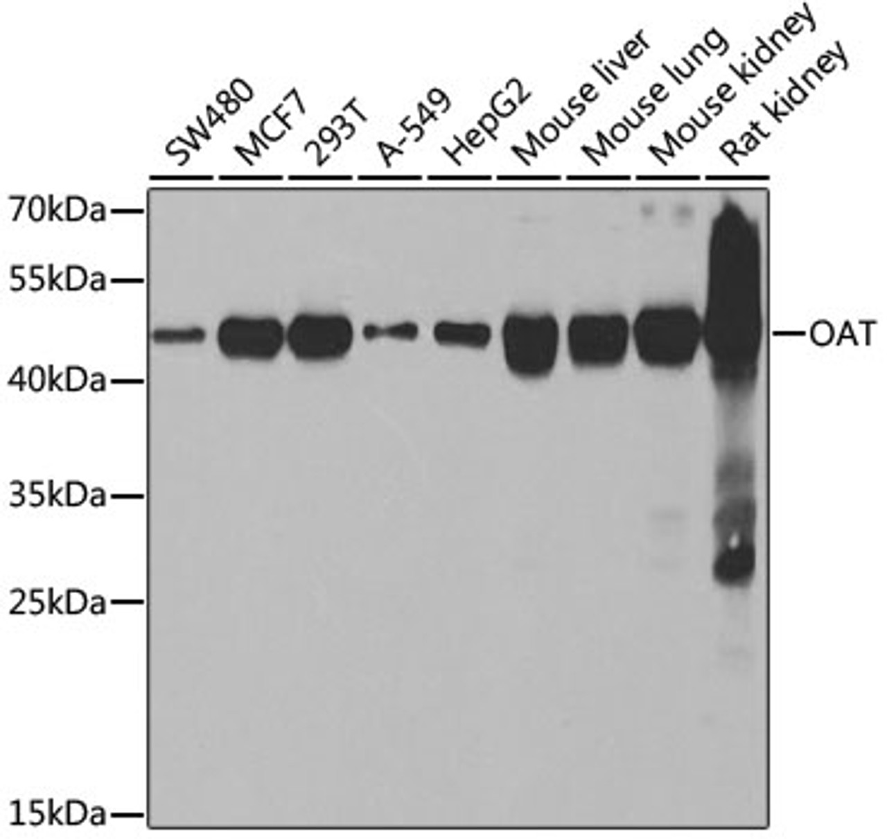 Western blot analysis of extracts of various cell lines, using OAT antibody (22-072) at 1:1000 dilution.<br/>Secondary antibody: HRP Goat Anti-Rabbit IgG (H+L) at 1:10000 dilution.<br/>Lysates/proteins: 25ug per lane.<br/>Blocking buffer: 3% nonfat dry milk in TBST.<br/>Detection: ECL Basic Kit.<br/>Exposure time: 10s.