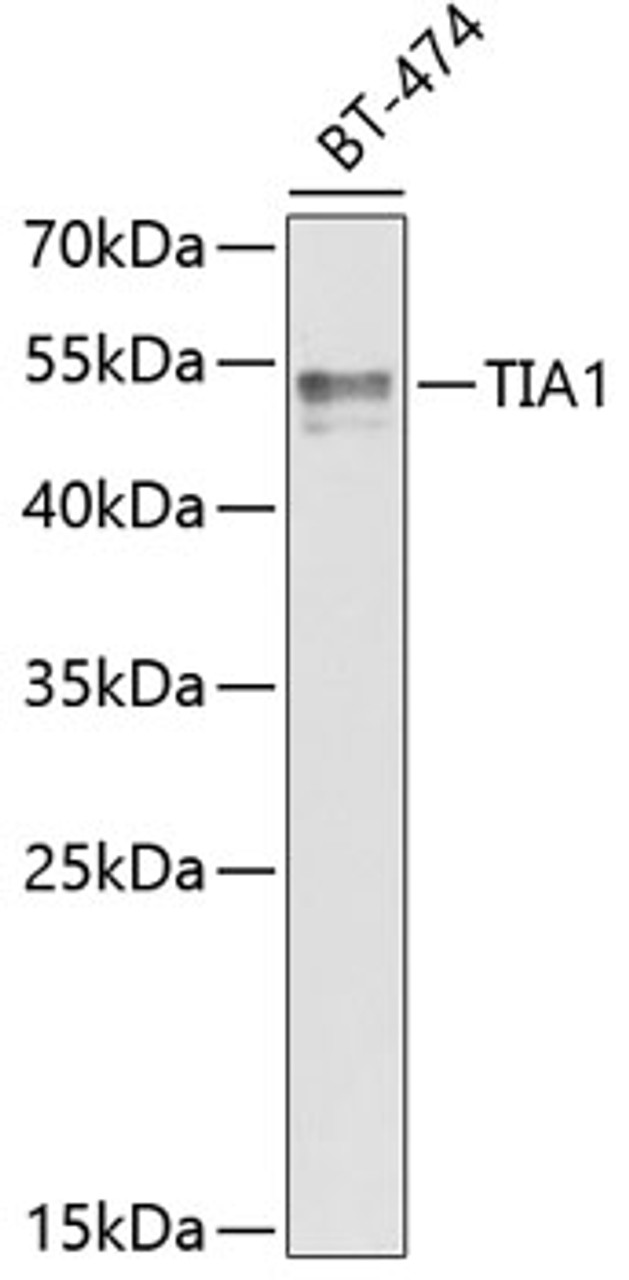 Western blot analysis of extracts of BT-474 cells, using TIA1 antibody (22-073) at 1:1000 dilution.<br/>Secondary antibody: HRP Goat Anti-Rabbit IgG (H+L) at 1:10000 dilution.<br/>Lysates/proteins: 25ug per lane.<br/>Blocking buffer: 3% nonfat dry milk in TBST.<br/>Detection: ECL Enhanced Kit.<br/>Exposure time: 60s.