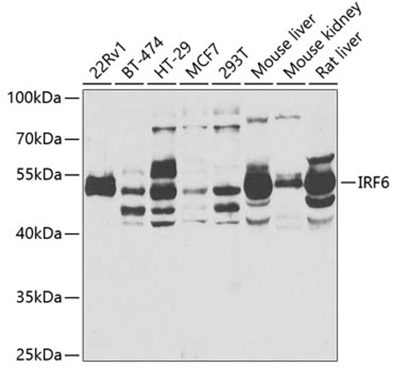 Western blot analysis of extracts of various cell lines, using IRF6 antibody (22-079) at 1:1000 dilution._Secondary antibody: HRP Goat Anti-Rabbit IgG (H+L) at 1:10000 dilution._Lysates/proteins: 25ug per lane._Blocking buffer: 3% nonfat dry milk in TBST._Detection: ECL Enhanced Kit._Exposure time: 15s.