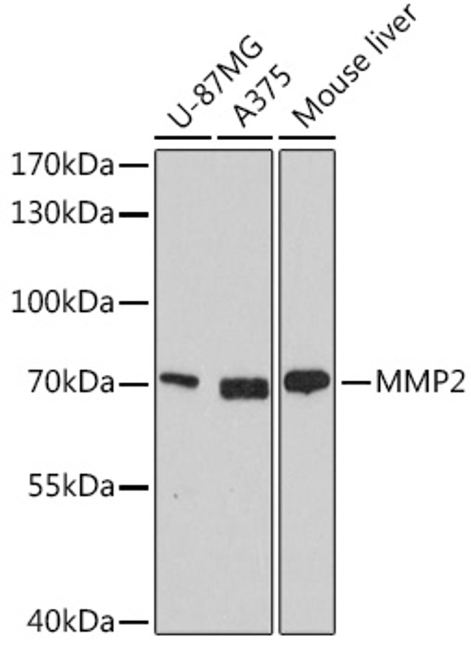 Western blot analysis of extracts of U-87MG cells, using MMP2 antibody (22-080) at 1:1000 dilution.<br/>Secondary antibody: HRP Goat Anti-Rabbit IgG (H+L) at 1:10000 dilution.<br/>Lysates/proteins: 25ug per lane.<br/>Blocking buffer: 3% nonfat dry milk in TBST.<br/>Detection: ECL Basic Kit.<br/>Exposure time: 30s.