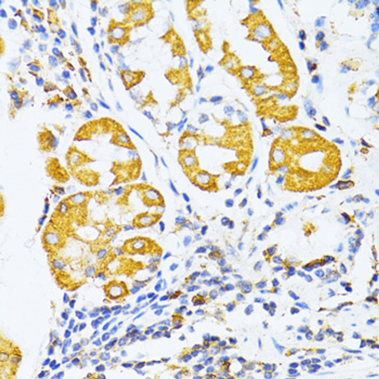 Immunohistochemistry of paraffin-embedded human stomach using MMP2 antibody (22-080) at dilution of 1:100 (40x lens) .