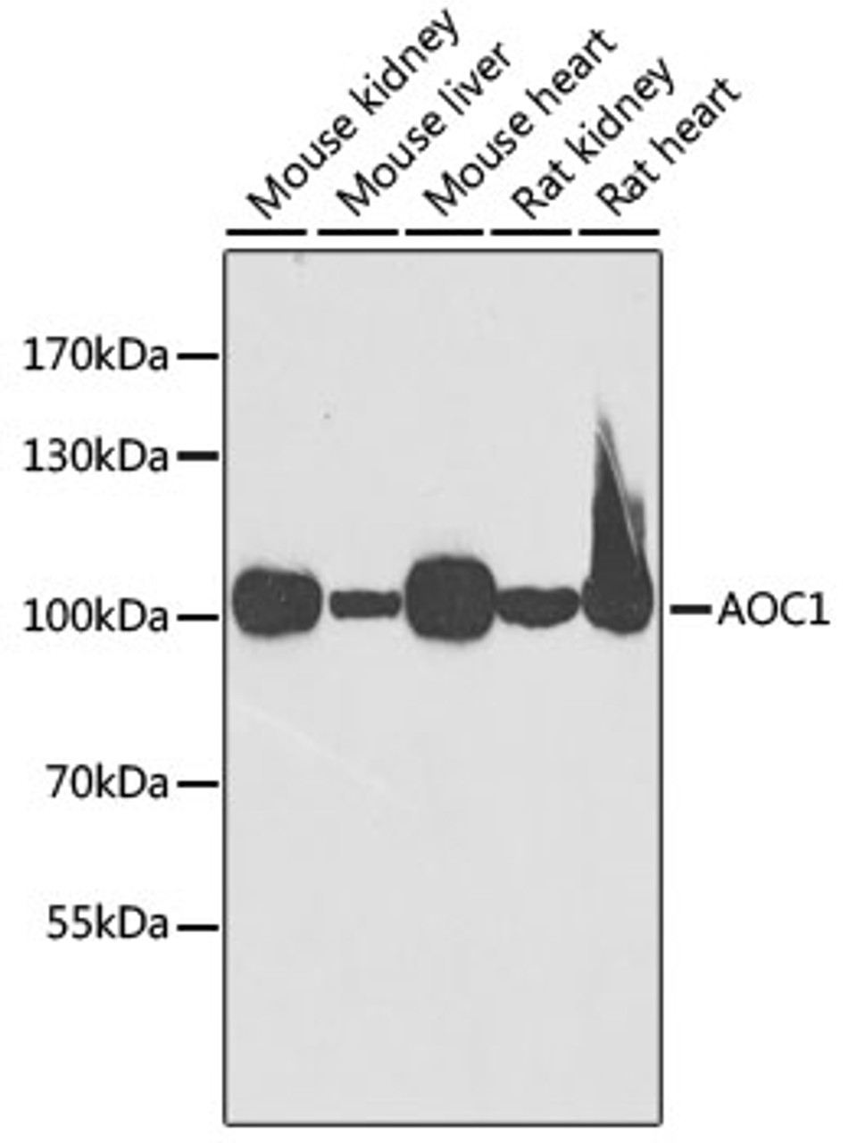 Western blot analysis of extracts of various cell lines, using AOC1 antibody (22-082) at 1:1000 dilution.<br/>Secondary antibody: HRP Goat Anti-Rabbit IgG (H+L) at 1:10000 dilution.<br/>Lysates/proteins: 25ug per lane.<br/>Blocking buffer: 3% nonfat dry milk in TBST.<br/>Detection: ECL Basic Kit.<br/>Exposure time: 30s.
