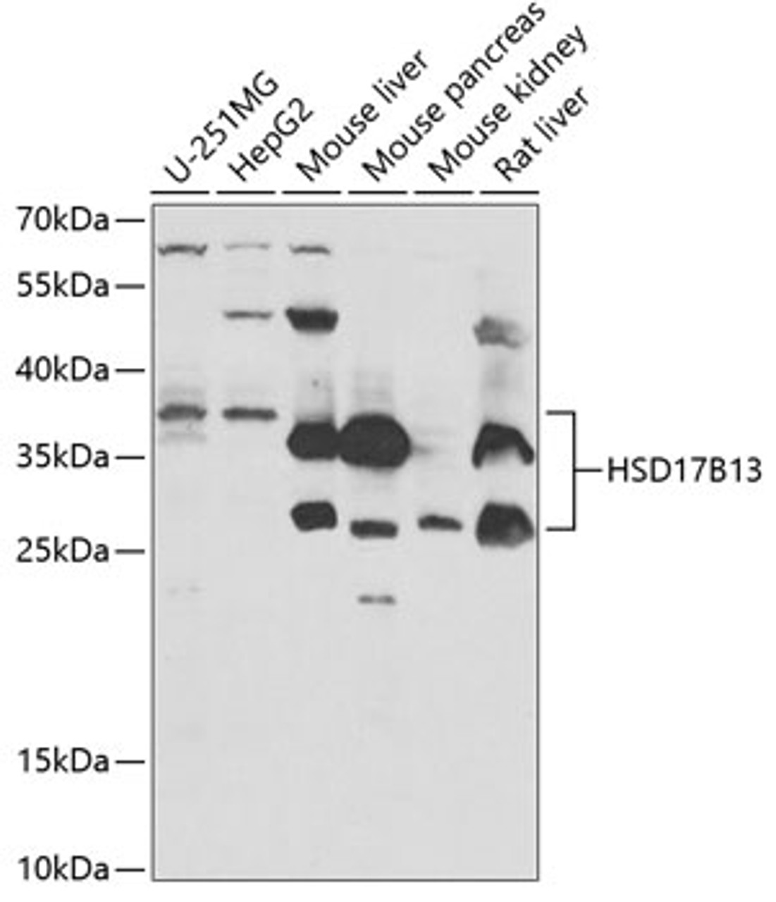 Western blot analysis of extracts of various cell lines, using HSD17B13 antibody (22-087) at 1:1000 dilution._Secondary antibody: HRP Goat Anti-Rabbit IgG (H+L) at 1:10000 dilution._Lysates/proteins: 25ug per lane._Blocking buffer: 3% nonfat dry milk in TBST._Detection: ECL Enhanced Kit._Exposure time: 90s.