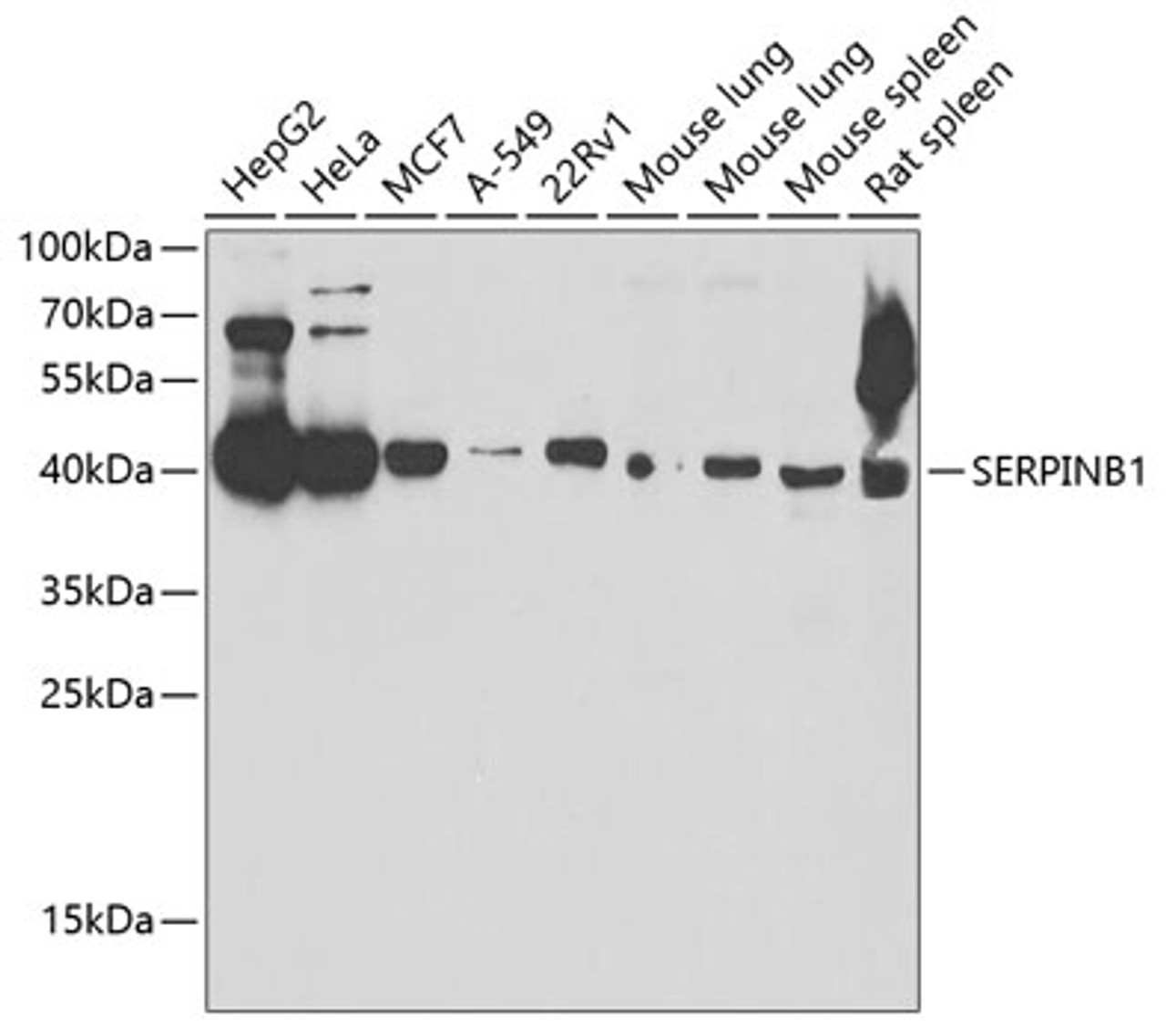 Western blot analysis of extracts of various cell lines, using SERPINB1 antibody (22-088) at 1:1000 dilution._Secondary antibody: HRP Goat Anti-Rabbit IgG (H+L) at 1:10000 dilution._Lysates/proteins: 25ug per lane._Blocking buffer: 3% nonfat dry milk in TBST._Detection: ECL Basic Kit._Exposure time: 60s.