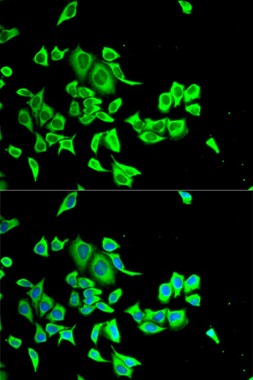 Immunofluorescence analysis of HeLa cells using SERPINB1 antibody (22-088) . Blue: DAPI for nuclear staining.